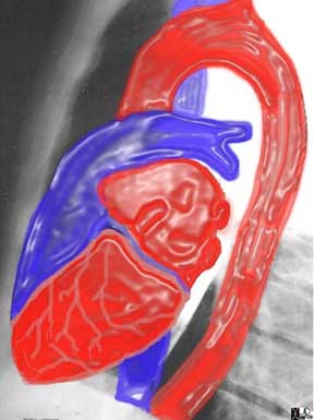 Heart | Applied Anatomy