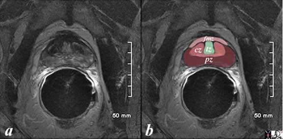 Prostate | Applied Anatomy