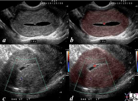 Uterus Part 2 | Applied Anatomy